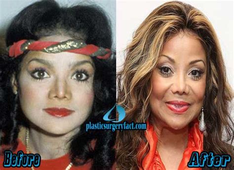 latoya jackson before plastic surgery|Wow, Latoya Jackson before and after plastic ...